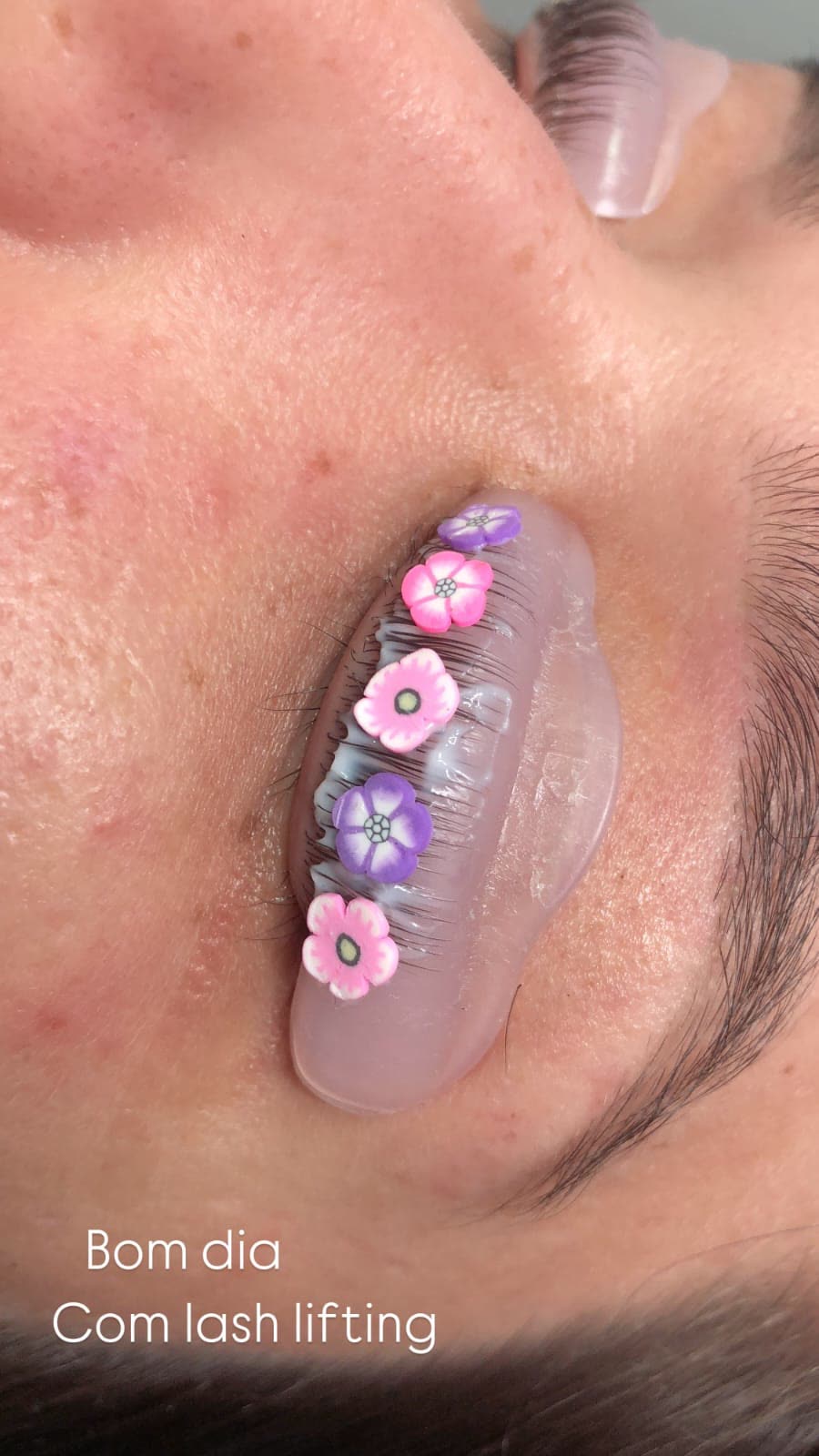 Resultado hidragloss labial